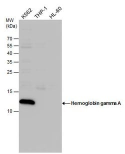 Invitrogen Hemoglobin gamma A Polyclonal Antibody 100 &mu;L; Unconjugated:Antibodies,