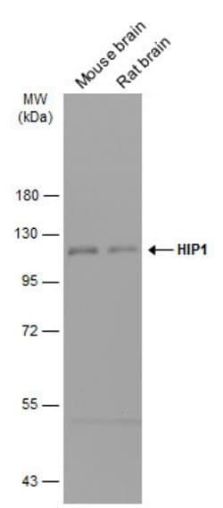 HIP1 Polyclonal Antibody:Antibodies, Polyclonal
