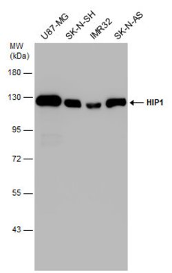HIP1 Polyclonal Antibody:Antibodies, Polyclonal