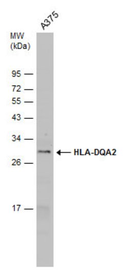 Invitrogen HLA-DQA2 Polyclonal Antibody 100 &mu;L; Unconjugated:Antibodies,