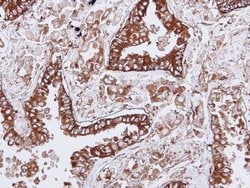 Invitrogen HLA-DQB1 Polyclonal Antibody 100 &mu;L; Unconjugated:Antibodies,