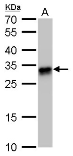 Invitrogen HLA-DQB1 Polyclonal Antibody 100 &mu;L; Unconjugated:Antibodies,