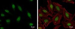 Invitrogen HMGB1/HMGB2 Polyclonal Antibody 100 &mu;L; Unconjugated:Antibodies,