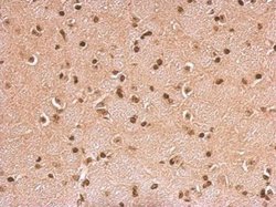 Invitrogen HMGB1/HMGB2 Polyclonal Antibody 100 &mu;L; Unconjugated:Antibodies,