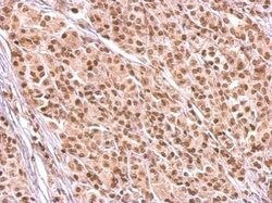 Invitrogen HMGB1/HMGB2 Polyclonal Antibody 100 &mu;L; Unconjugated:Antibodies,