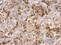 Invitrogen HMGB2 Polyclonal Antibody 100 &mu;L; Unconjugated:Antibodies,