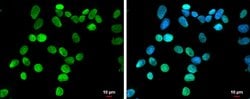HMGA1 Polyclonal Antibody:Antibodies, Polyclonal