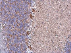 Invitrogen HSPA9 Polyclonal Antibody 100 &mu;L; Unconjugated:Antibodies,
