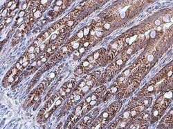 Invitrogen HSPA9 Polyclonal Antibody 100 &mu;L; Unconjugated:Antibodies,