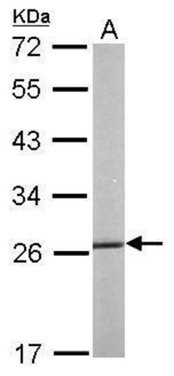 Invitrogen HSP27 Polyclonal Antibody 100 &mu;L; Unconjugated:Antibodies,