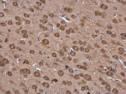 Invitrogen IARS Polyclonal Antibody 100 &mu;L; Unconjugated:Antibodies,