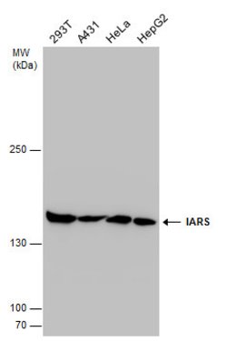 Invitrogen IARS Polyclonal Antibody 100 &mu;L; Unconjugated:Antibodies,