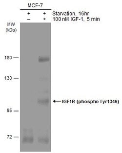 Invitrogen Phospho-IGF1R beta (Tyr1316) Polyclonal Antibody 100 &mu;L;