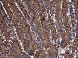 Invitrogen CYR61 Polyclonal Antibody 100 &mu;L; Unconjugated:Antibodies,