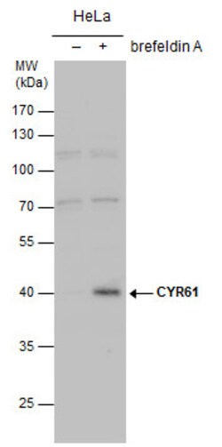 Invitrogen CYR61 Polyclonal Antibody 100 &mu;L; Unconjugated:Antibodies,