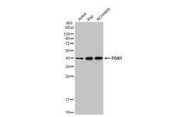 Invitrogen PDX1 Polyclonal Antibody 100 &mu;L; Unconjugated:Antibodies,
