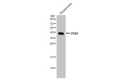 Invitrogen PDX1 Polyclonal Antibody 100 &mu;L; Unconjugated:Antibodies,