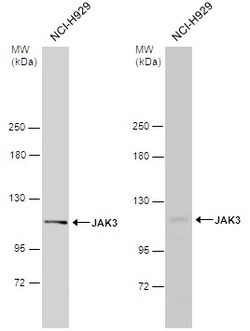 Invitrogen JAK3 Polyclonal Antibody 100 &mu;L | Buy Online | Invitrogen&trade; | Fisher Scientific