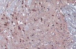 Invitrogen JARID2 Polyclonal Antibody 100 &mu;L; Unconjugated:Antibodies,