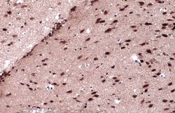 Invitrogen JARID2 Polyclonal Antibody 100 &mu;L; Unconjugated:Antibodies,