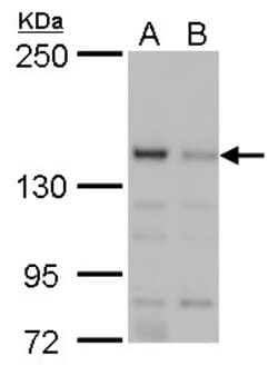 Invitrogen JARID2 Polyclonal Antibody 100 &mu;L; Unconjugated:Antibodies,