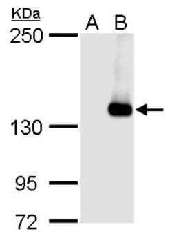 Invitrogen JARID2 Polyclonal Antibody 100 &mu;L; Unconjugated:Antibodies,
