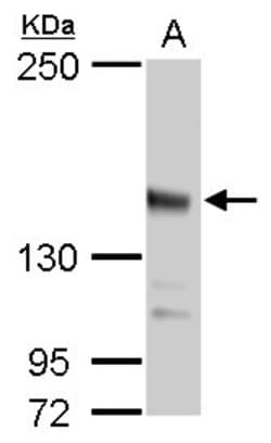 Invitrogen JARID2 Polyclonal Antibody 100 &mu;L; Unconjugated:Antibodies,