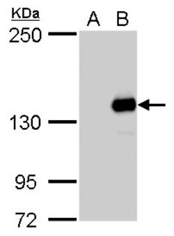 Invitrogen JARID2 Polyclonal Antibody 100 &mu;L | Buy Online | Invitrogen&trade; | Fisher Scientific