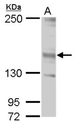 Invitrogen JARID2 Polyclonal Antibody 100 &mu;L | Buy Online | Invitrogen&trade; | Fisher Scientific