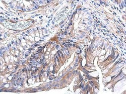 Invitrogen Pan Ras Polyclonal Antibody 100 &mu;L; Unconjugated:Antibodies,