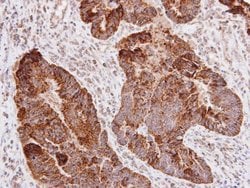 Invitrogen CD171 (L1CAM) Polyclonal Antibody 100 &mu;L; Unconjugated:Antibodies,