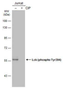Invitrogen Phospho-LCK (Tyr394) Polyclonal Antibody 100 &mu;L; Unconjugated:Antibodies,