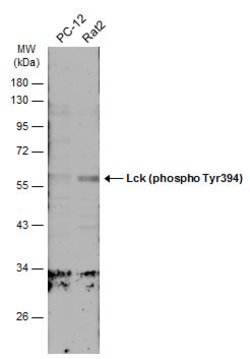 Invitrogen Phospho-LCK (Tyr394) Polyclonal Antibody 100 &mu;L; Unconjugated:Antibodies,