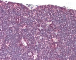 Invitrogen LCK Polyclonal Antibody 100 &mu;L; Unconjugated:Antibodies,