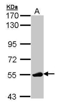 Invitrogen LCK Polyclonal Antibody 100 &mu;L; Unconjugated:Antibodies,