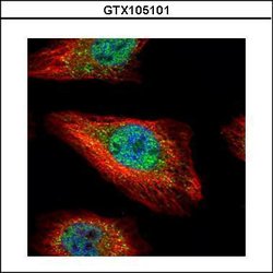 Invitrogen SMAD5 Polyclonal Antibody 100 &mu;L | Buy Online | Invitrogen&trade; | Fisher Scientific