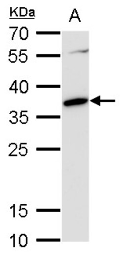 Invitrogen c-MAF Polyclonal Antibody 100 &mu;L; Unconjugated:Antibodies,