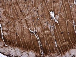 Invitrogen ME2 Polyclonal Antibody 100 &mu;L; Unconjugated:Antibodies,