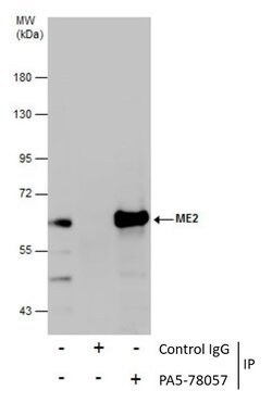 Invitrogen ME2 Polyclonal Antibody 100 &mu;L; Unconjugated:Antibodies,