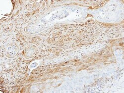 Invitrogen MEKK3 Polyclonal Antibody 100 &mu;L; Unconjugated:Antibodies,