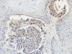 Invitrogen MEKK3 Polyclonal Antibody 100 &mu;L; Unconjugated:Antibodies,