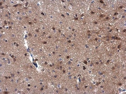 Invitrogen MEKK3 Polyclonal Antibody 100 &mu;L; Unconjugated:Antibodies,