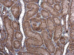Invitrogen MEKK3 Polyclonal Antibody 100 &mu;L; Unconjugated:Antibodies,