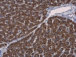 Invitrogen MGST1 Polyclonal Antibody 100 &mu;L; Unconjugated:Antibodies,