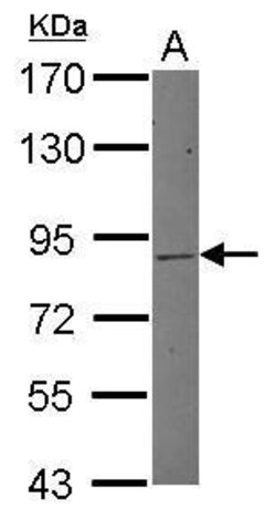 Invitrogen MLH1 Polyclonal Antibody 100 &mu;L | Buy Online | Invitrogen&trade; | Fisher Scientific