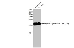 Invitrogen MYL2 Polyclonal Antibody 100 &mu;L; Unconjugated:Antibodies,