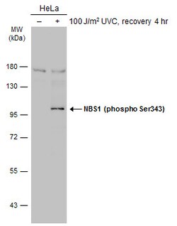 Invitrogen Phospho-NBS1 (Ser343) Polyclonal Antibody 100 &mu;L; Unconjugated:Antibodies,