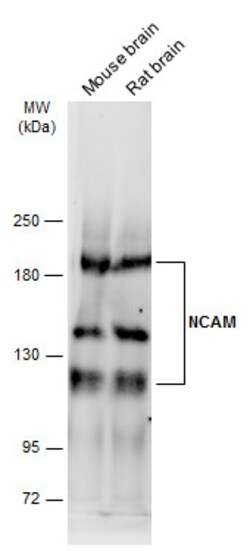 Invitrogen CD56 (NCAM) Polyclonal Antibody 100 &mu;L | Buy Online | Invitrogen&trade; | Fisher Scientific
