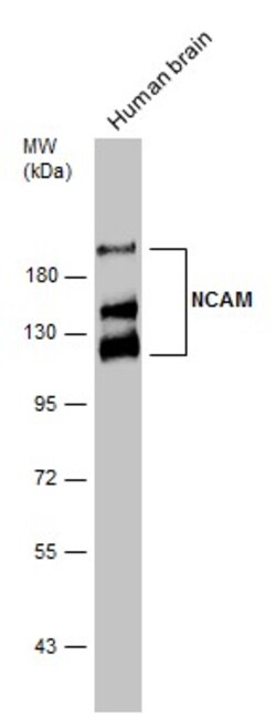 Invitrogen CD56 (NCAM) Polyclonal Antibody 100 &mu;L | Buy Online | Invitrogen&trade; | Fisher Scientific