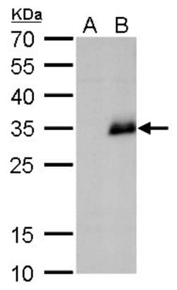 Invitrogen Neurogenin 1 Polyclonal Antibody 100 &mu;L | Buy Online | Invitrogen&trade; | Fisher Scientific